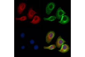 ABIN7094458 and ABIN7098506 staining Hela cells by IF/ICC. (CBX7 抗体  (N-Term))