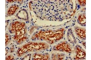 Immunohistochemistry of paraffin-embedded human kidney tissue using ABIN6953147 at dilution of 1:100