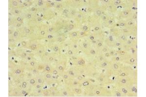 Immunohistochemistry (IHC) image for anti-Cytochrome P450, Family 2, Subfamily J, Polypeptide 2 (CYP2J2) (AA 328-502) antibody (ABIN7149254)