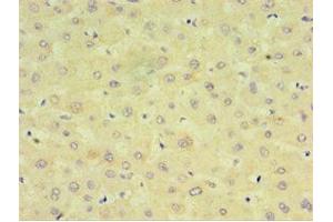 Immunohistochemistry of paraffin-embedded human liver tissue using ABIN7149254 at dilution of 1:100 (CYP2J2 抗体  (AA 328-502))