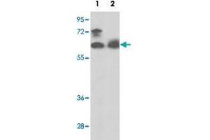 Western blot analysis of PANK1 polyclonal antibody  in MCF-7 cell line (Lane 1) and mouse spleen tissue lysates (Lane 2)(35 ug/lane). (PANK1 抗体  (N-Term))