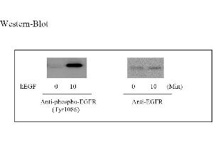 Image no. 5 for Epidermal Growth Factor Receptor (EGFR) ELISA Kit (ABIN625224)