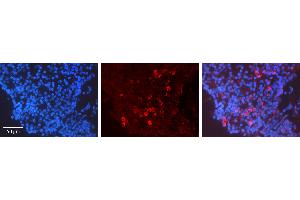 Rabbit Anti-CCNA2 Antibody   Formalin Fixed Paraffin Embedded Tissue: Human Lymph Node Tissue Observed Staining: Cytoplasm Primary Antibody Concentration: 1:600 Other Working Concentrations: N/A Secondary Antibody: Donkey anti-Rabbit-Cy3 Secondary Antibody Concentration: 1:200 Magnification: 20X Exposure Time: 0.