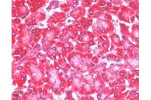 Immunohistochemistry (IHC) image for anti-Eukaryotic Translation Initiation Factor 4E Nuclear Import Factor 1 (EIF4ENIF1) (C-Term) antibody (ABIN185154)