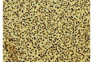 ABIN6277605 at 1/100 staining Mouse liver tissue by IHC-P. (SIGMAR1 抗体  (Internal Region))