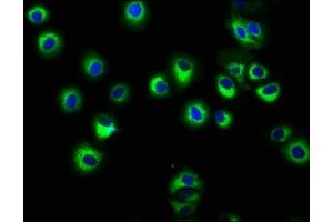 Immunofluorescence staining of HepG2 cells with ABIN7155571 at 1:166, counter-stained with DAPI. (HLA-C 抗体  (AA 62-306))