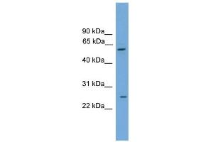 WB Suggested Anti-POT1 Antibody Titration: 0. (POT1 抗体  (Middle Region))