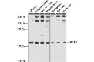 Western blot analysis of extracts of various cell lines, using RPLP1 antibody (ABIN6129657, ABIN6147166, ABIN6147167 and ABIN6222445) at 1:1000 dilution. (RPLP1 抗体  (AA 1-114))
