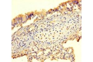 Immunohistochemistry of paraffin-embedded human lung tissue using ABIN7145692 at dilution of 1:100
