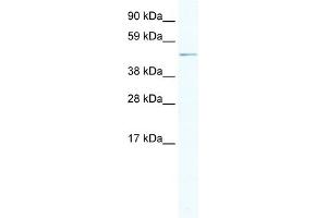 WB Suggested Anti-ARX Antibody Titration:  2. (Arx 抗体  (Middle Region))