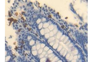 Immunohistochemistry (IHC) image for anti-Ornithine Carbamoyltransferase (OTC) (AA 78-129) antibody (ABIN7433690)