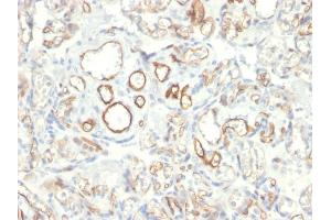 Formalin-fixed, paraffin-embedded human Placenta stained with Podocalyxin Mouse Monoclonal Antibody (PODXL/2185). (PODXL 抗体  (AA 310-447))