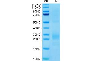 MIF Protein (AA 2-115) (His tag)