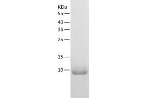 TRA2B Protein (AA 120-199) (His tag)