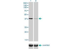 Western blot analysis of EIF2C2 over-expressed 293 cell line, cotransfected with EIF2C2 Validated Chimera RNAi (Lane 2) or non-transfected control (Lane 1). (AGO2 抗体  (AA 1-377))