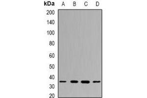 Western blot analysis of PPX expression in MCF7 (A), NIH3T3 (B), mouse testis (C), mouse spleen (D) whole cell lysates. (PPP4C 抗体)