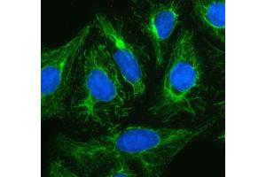 IF analysis of Plectin using anti-Plectin antibody (ABIN3043900).