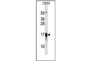 Western blot analysis of Dysadherin / FXYD5 Antibody (Center) in CEM cell line lysates (35ug/lane).