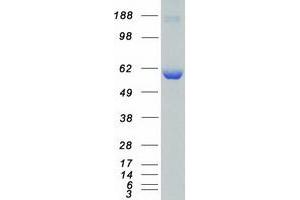Validation with Western Blot (CAMKK1 Protein (Transcript Variant 1) (Myc-DYKDDDDK Tag))