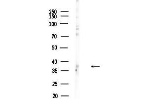 anti-Myocyte Enhancer Factor 2B (MEF2B) (Internal Region) antibody