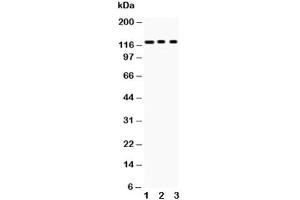 Western blot testing of PLD1 antibody and Lane 1:  mouse heart (PLD1 抗体  (AA 1-330))
