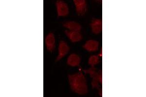 ABIN6267027 staining Hela by IF/ICC.