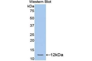 Western blot analysis of the recombinant protein. (TCF20 抗体  (AA 125-213))