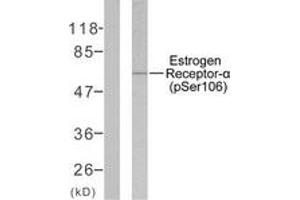 Western blot analysis of extracts from MCF7 cells, using Estrogen Receptor-alpha (Phospho-Ser106) Antibody. (Estrogen Receptor alpha 抗体  (pSer106))