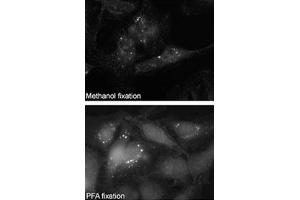 Immunofluorescence staining of SQSTM1 polyclonal antibody  on Methanol-fixed and PFA fixed HeLa cells. (SQSTM1 抗体  (C-Term))