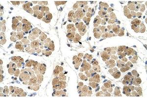 Immunohistochemical staining (Formalin-fixed paraffin-embedded sections) of human muscle with KLHL31 polyclonal antibody . (KLHL31 抗体  (AA 501-550))
