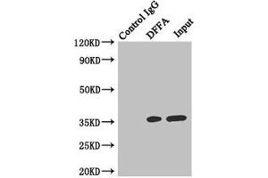 Immunoprecipitating DFFA in Hela whole cell lysate Lane 1: Rabbit control IgG instead of (1 μg) instead of ABIN7150176 in Hela whole cell lysate. (DFFA 抗体  (AA 1-331))