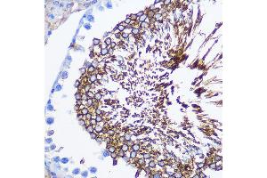 Immunohistochemistry (IHC) image for anti-Sperm Adhesion Molecule 1 (PH-20 Hyaluronidase, Zona Pellucida Binding) (SPAM1) (AA 100-300) antibody (ABIN1513554)