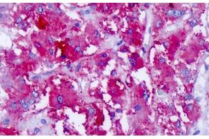 Immunohistochemistry (IHC) image for anti-Cadherin EGF LAG Seven Pass G-Type Receptor 1 (CELSR1) (C-Term) antibody (ABIN1048425)