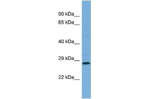 Western Blotting (WB) image for anti-Mediator Complex Subunit 19 (MED19) (Middle Region) antibody (ABIN2786282) (MED19 抗体  (Middle Region))