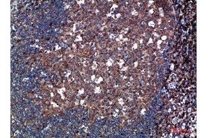 Immunohistochemical analysis of paraffin-embedded human-tonsil, antibody was diluted at 1:200 (TPSD1 抗体  (AA 51-100))