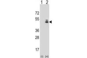 Western Blotting (WB) image for anti-Actin, gamma 1 (ACTG1) antibody (ABIN3002670) (Actin, gamma 1 抗体)