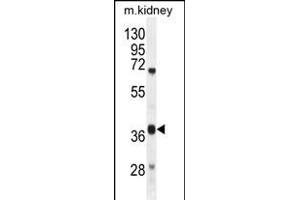 DUS4L Antibody (Center) (ABIN654982 and ABIN2844622) western blot analysis in mouse kidney tissue lysates (35 μg/lane). (DUS4L 抗体  (AA 141-170))