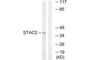 Western blot analysis of extracts from K562 cells, using STAC2 antibody. (STAC2 抗体)
