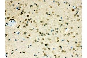 IHC-P testing of VCP antibody and mouse brain tissue (VCP 抗体  (AA 732-760))