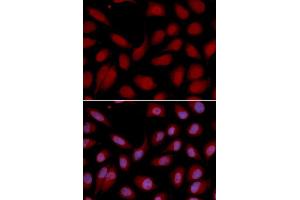 Immunofluorescence analysis of U2OS cell using CD3E antibody. (CD3 epsilon 抗体  (AA 25-207))
