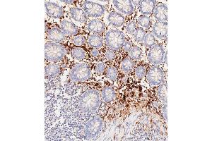 Immunohistochemical analysis of paraffin-embedded Human colon tissue using C performed on the Leica® BOND RXm. (Haptoglobin 抗体  (Center))