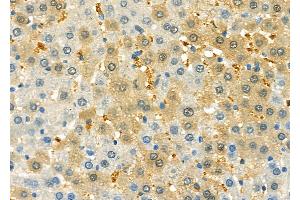 ABIN6261280 and ABIN6279617 at 1/100 staining Rat liver tissue by IHC-P. (Non-Syndromic Hearing Impairment Protein 5 (GSDME) (C-Term) 抗体)