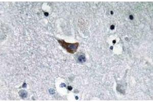 Immunohistochemistry (IHC) analyzes of GluR1 antibody in paraffin-embedded human brain tissue. (Glutamate Receptor 1 抗体)