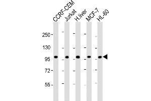 All lanes : Anti-RSBN1 Antibody (N-term) at 1:2000 dilution Lane 1: CCRF-CEM whole cell lysate Lane 2: Jurkat whole cell lysate Lane 3: human liver lysate Lane 4: MCF-7 whole cell lysate Lane 5: HL-60 whole cell lysate Lysates/proteins at 20 μg per lane. (RSBN1 抗体  (N-Term))