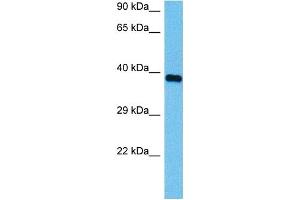 Host:  Mouse  Target Name:  HSD17B1  Sample Tissue:  Mouse Heart  Antibody Dilution:  1ug/ml (HSD17B1 抗体  (N-Term))
