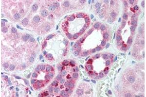 Human Kidney (formalin-fixed, paraffin-embedded) stained with SERTAD1 antibody ABIN214142 at 5 ug/ml followed by biotinylated goat anti-rabbit IgG secondary antibody ABIN481713, alkaline phosphatase-streptavidin and chromogen. (SERTAD1 抗体  (N-Term))