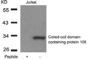 Western blot analysis of extracts from Jurkat cells using Coiled-coil domain-containing protein 106and the same antibody preincubated with blocking peptide. (CCDC106 抗体  (Coiled coil domain))