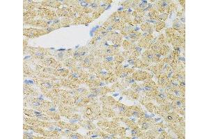 Immunohistochemistry (Paraffin-embedded Sections) (IHC (p)) image for anti-Inositol Polyphosphate-5-Phosphatase J (INPP5J) antibody (ABIN7262513)