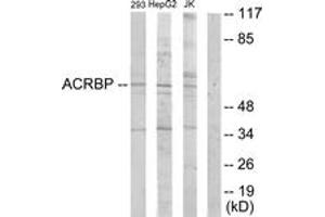 Western blot analysis of extracts from HepG2/Jurkat/293 cells, using ACRBP Antibody.