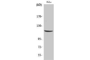 Western Blotting (WB) image for anti-Caspase Recruitment Domain Family, Member 6 (CARD6) (N-Term) antibody (ABIN3183650) (CARD6 抗体  (N-Term))